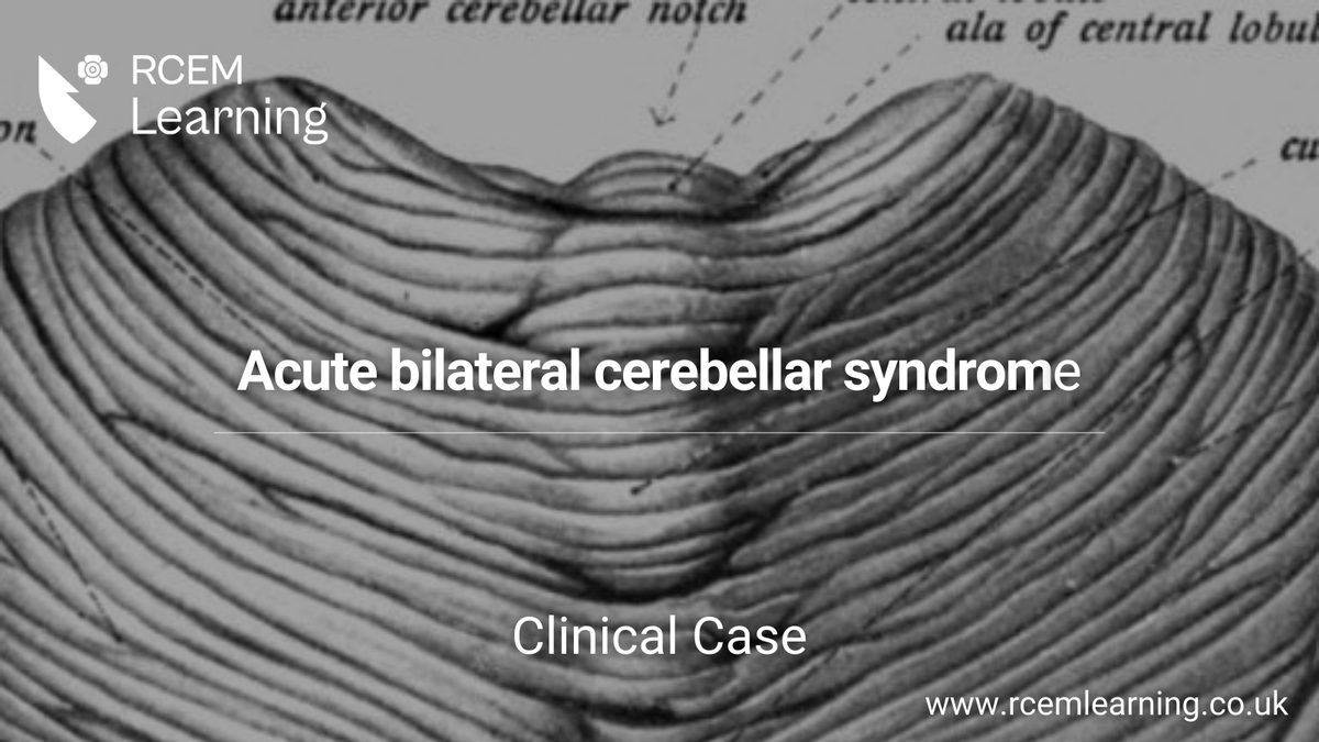 UPDATE: A 69-year-old man presents to the Emergency Department after a minor road traffic accident. Read our #ClinicalCase here: rcemlearning.co.uk/modules/acute-…