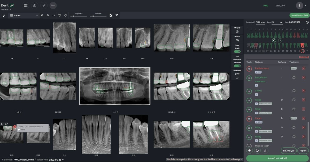 DentistryToday's tweet photo. https://t.co/n9ha8D1FYf Earns FDA Clearance for Breakthrough Dental AI Solutions

https://t.co/o3fhpJD6Ll https://t.co/UpNZlAPxOM