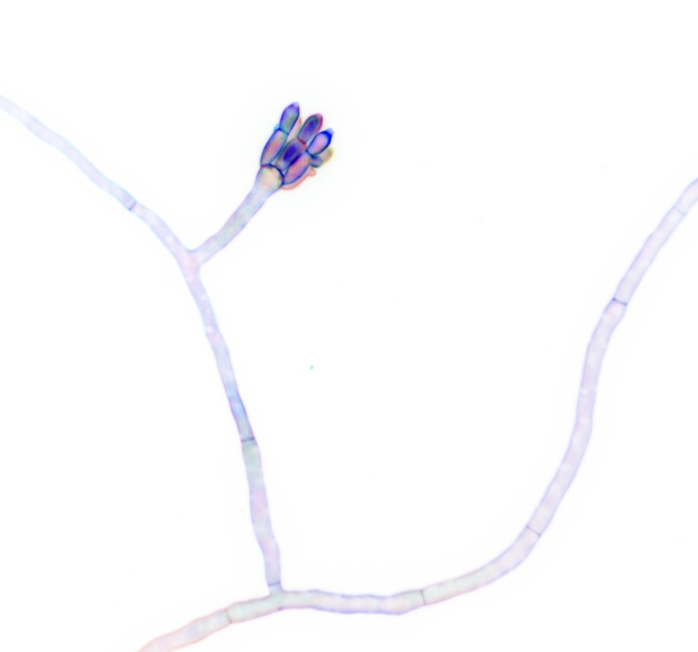 come join our team! (picture for the fungal aficionados; developing Aspergillus nidulans conidiophore)