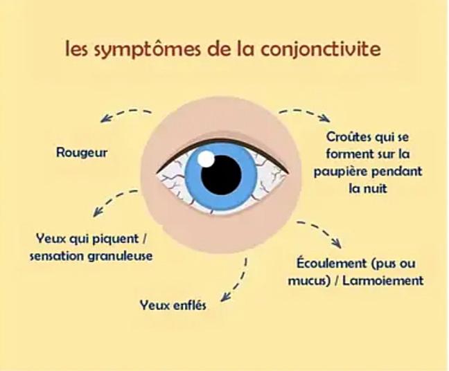 DPS (Direction Promotion de la Santé) / MINSANTE tweet media
