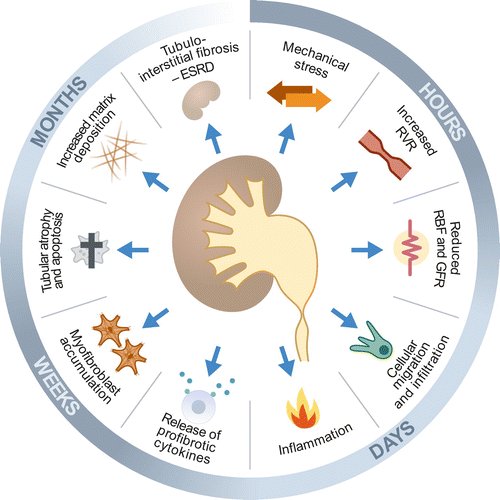 ASPNeph's tweet photo. Obstructive nephropathy and molecular pathophysiology of renal interstitial fibrosis https://t.co/8gMAn9XquD Physiological Reviews https://t.co/ZAENNKwnJc