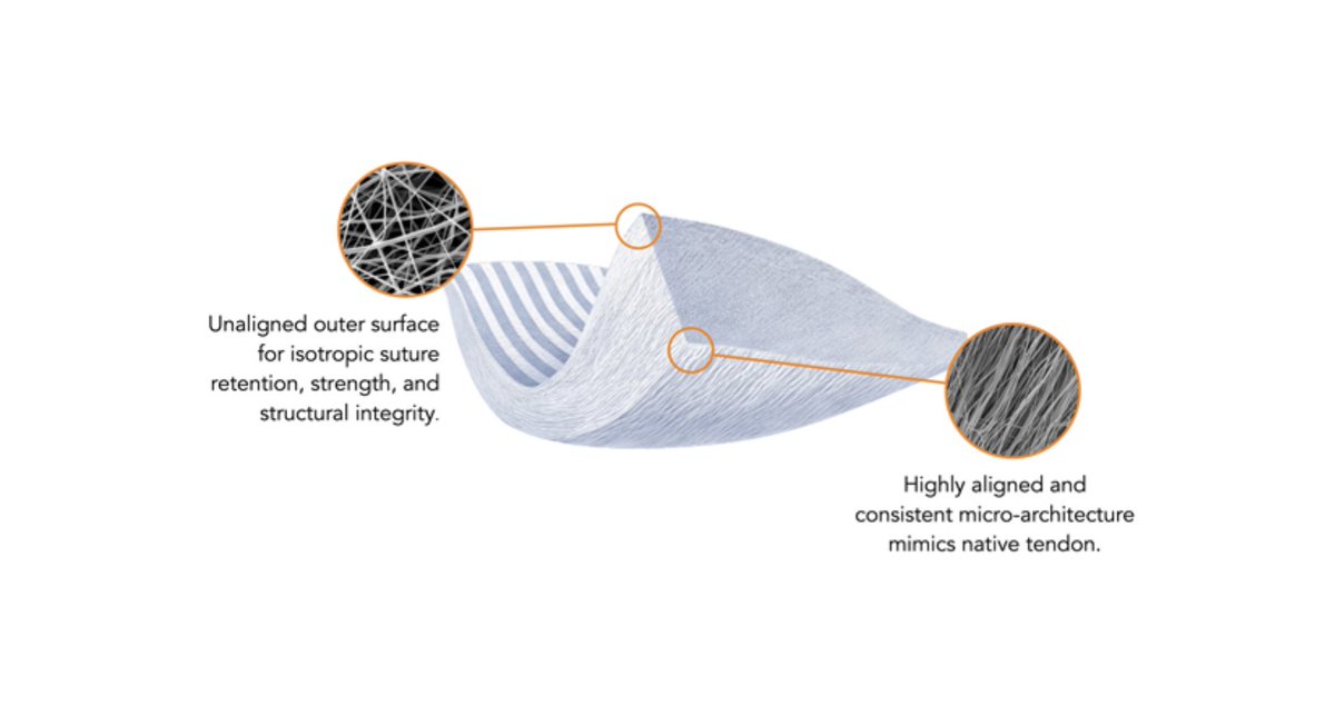Ryortho1's tweet image. LifeNet Health, the leader in allograft tissue R&amp;amp;D, is suing #Embody and Zimmer Biomet over alleged IP theft and infringement. Consequential case with serious implications. Details here. ryortho.com/2023/10/lifene…

#LifeNetHealth #ZimmerBiomet #otw #orthopedicsthisweek #orthopedics