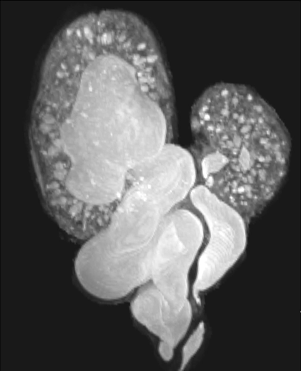 Kidney_Int tweet picture