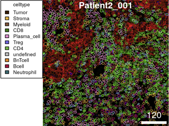 Standard_BioT's tweet photo. We’d like to share this @NatureProtocols publication, outlining image analysis options including image segmentation, feature extraction and spatially resolved single-cell analysis.
Windhager et al. 2023: https://t.co/N0nSi70I06
#multipleximaging #cellsegmentation #singlecell https://t.co/CsRWC8Owg7
