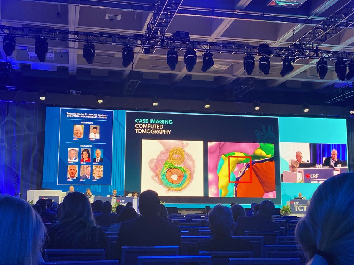 #TCT2023 was a resounding success! Thank you to everyone who made this possible. DASI Simulations was featured in multiple live cases and scientific presentations! We couldn't be more ecstatic to be recognized as the next generation of #predictivemodeling using our #AI based