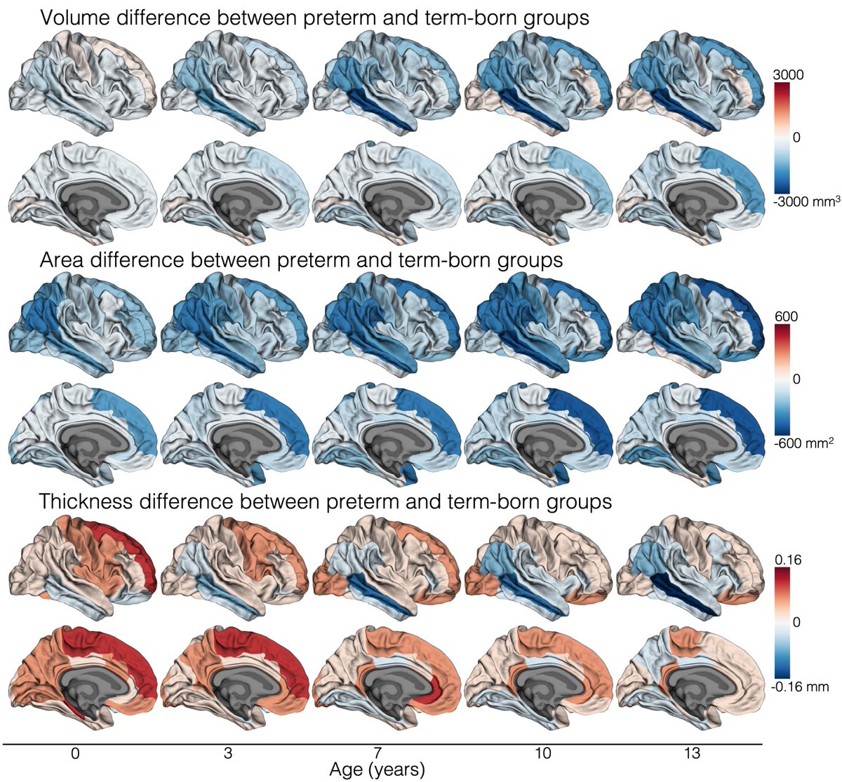 Kelly et al. compare cortical developmental trajectories in children born at term versus very preterm, and show that the impact of very preterm birth on cortical growth is amplified from infancy to adolescence. tinyurl.com/262mxyxx