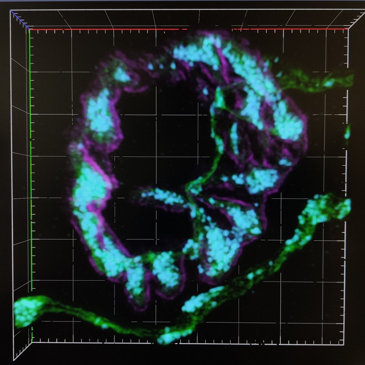 Mitochondria (cyan) in the neuromuscular junctions. 

First one to be speed mode. Get this 3 channels, medium sized frame, 27 z-stacks within a minute.

Second one to be resolution mode. Really into the detailed structure.

Wow, speed and quality, Airyscan 2 is just crazy.