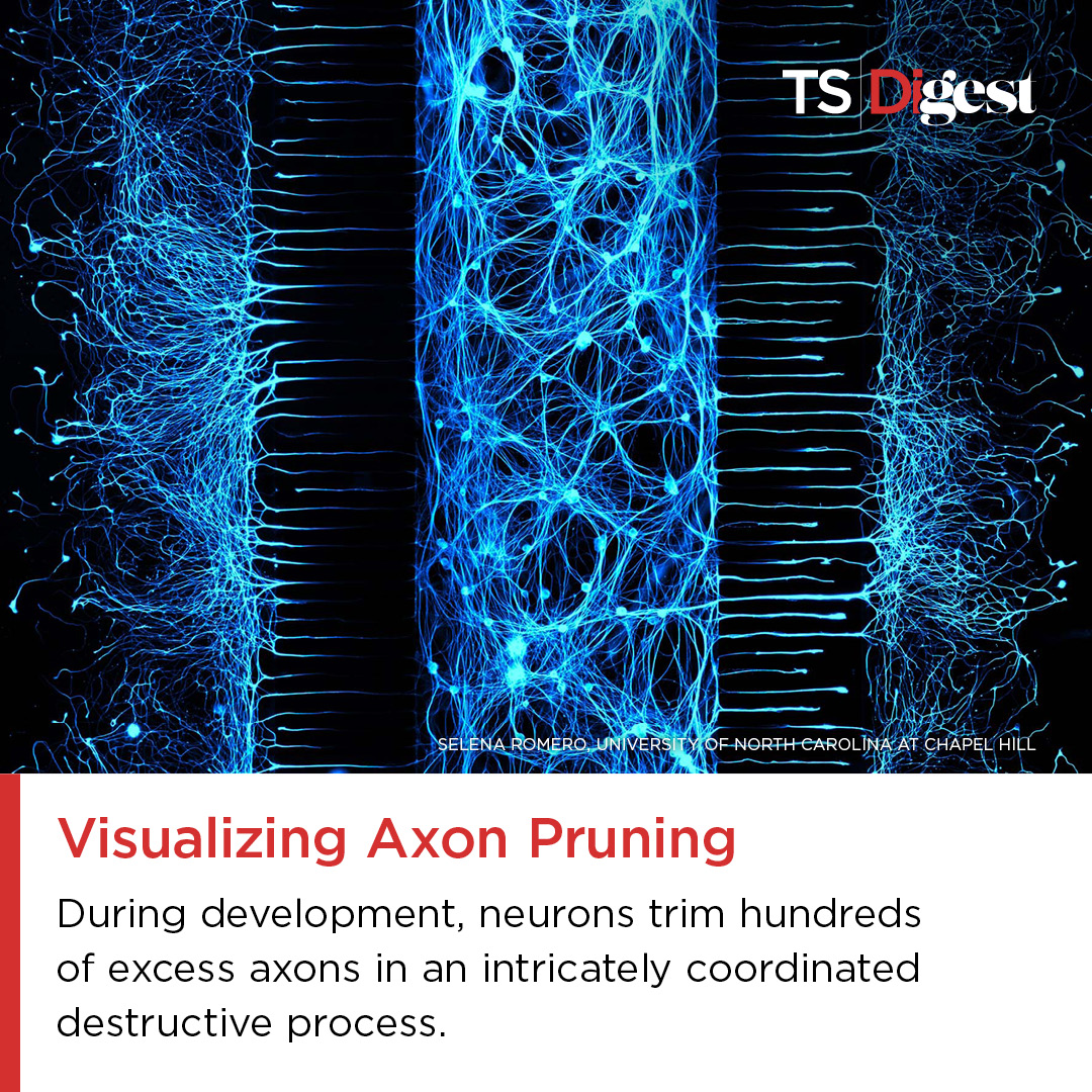 TheScientistLLC's tweet photo. “I was blown away by how striking it was,” said Selena Romero of the @DeshmukhLab @UNC about the first time she used a unique three-compartment microfluidic chamber to view the rarely seen process of axon pruning.
Read the #ScienceSnapshot story here:
https://t.co/kDMZE3zLb6 https://t.co/ksyltuWiCh