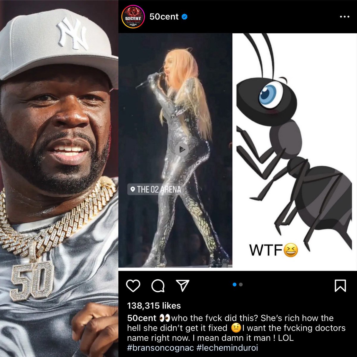 50 Cent fires shots at Madonna comparing her body to an “Ants” after surgery:

“Who the f*ck did this… she’s rich how the hell she didn’t get it fixed… I want the f*cking doctors name right now”