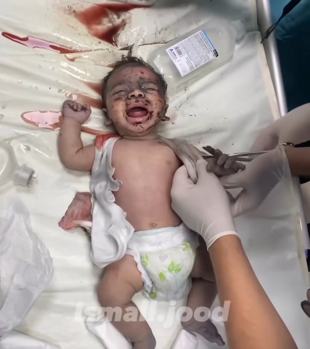 #SaveGazaCivilians 
#CeaseFireInGazaaanow