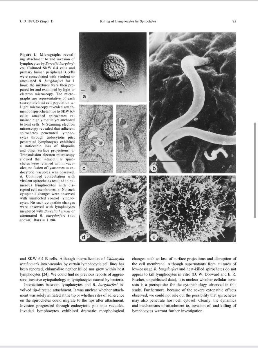BeauxReliosis's tweet photo. “We found that B. burgdorferi actively attaches to, invades, and kills human B and T lymphocytes.”

-Rocky Mountain Laboratory (NIAID), 1996

#LymeDisease https://t.co/R7RtM3alEN