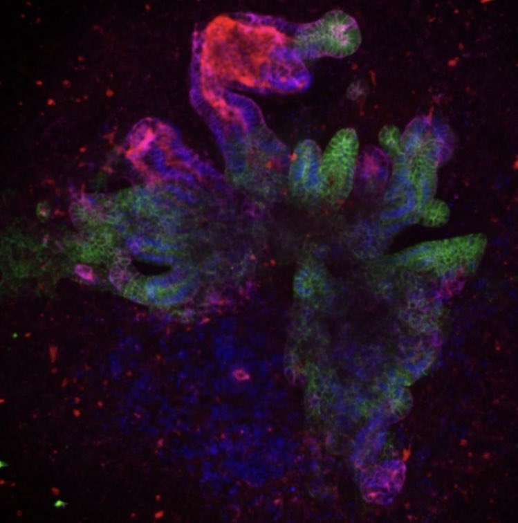 Beno Freedman tweet media