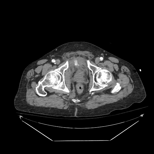 Albany IR tweet media