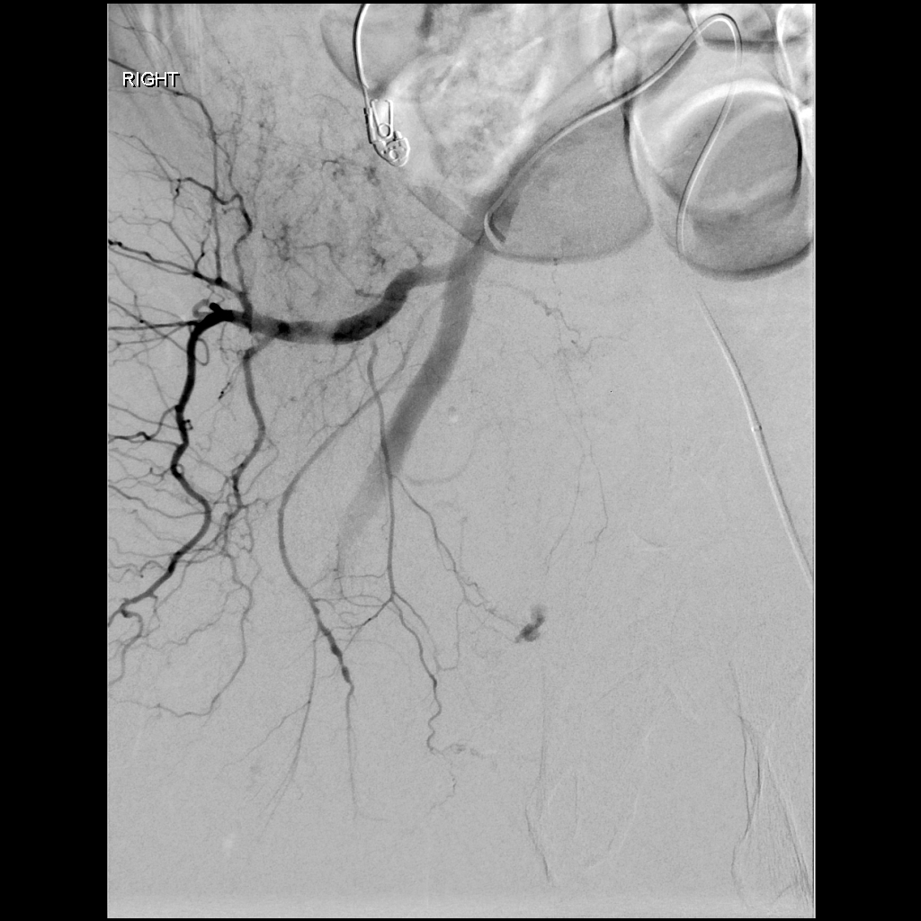 Albany IR tweet media