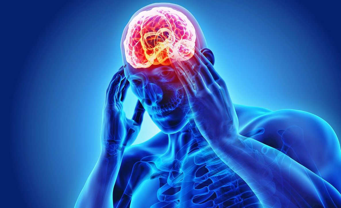 RisingKashmir's tweet photo. #Broadly Understanding #Migraine - I

Writes  Dr. Tasaduk Hussain Itoo

https://t.co/WIqusJiK4N https://t.co/FEODgr0AAW