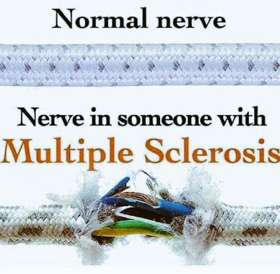 EndMsNow's tweet image. @jakemar711 Thank you for taking a minute out of your day to follow me, I appreciate it. Take Care &amp;amp; Stay Safe. #MSconnections 
#MSNetwork 
#MSCommunity 
#WeHaveMS 
#URNotAlone 
#ShiftMS 
#CureMS 
#chronicillness 
#WeGetIt