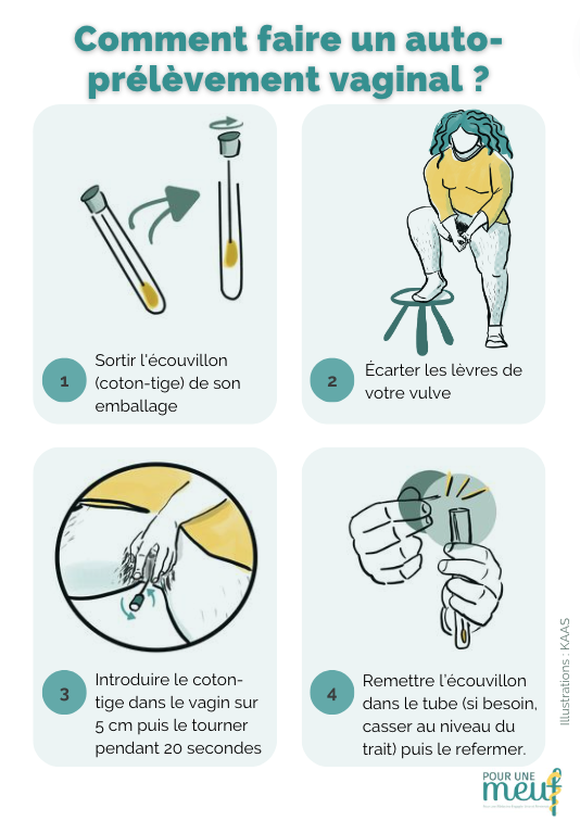 🆕 AFFICHE AUTO-PRÉLÈVEMENT VAGINAL
Pour une M.E.U.F a créé une affiche à destination de tous·tes sur l'auto-prélèvement vaginal.
Cette affiche est accessible en libre accès, gratuite, imprimable. Elle existe en 2 versions selon l’écouvillon utilisé. 
➡️ pourunemeuf.org/2023/10/27/ele…