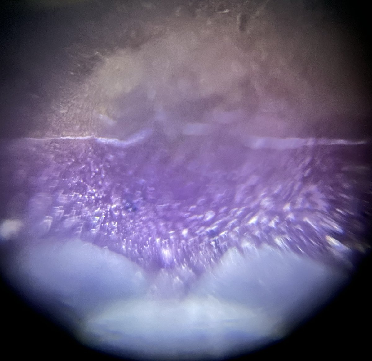 TeamFoldscope's tweet photo. Day 6: Foldscope Halloween Candy Daily Challenge!
Can you identify the candy under the Foldscope?
Comment below with your guess, then go to https://t.co/iA20nI4cdZ to find the answer!
*answers will be posted the following day* https://t.co/JxrHTPbpG5