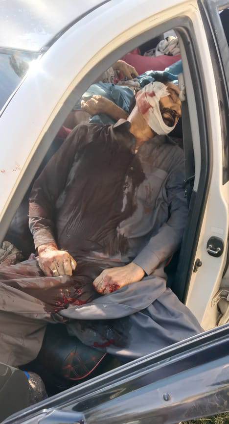 aleenafatima_02's tweet photo. Shia target killing start in parachinar , please raise your voice oppressed nation .๐
#Parachinar #Shiableeding #Shiagenocide https://t.co/25eCPA3Tp2