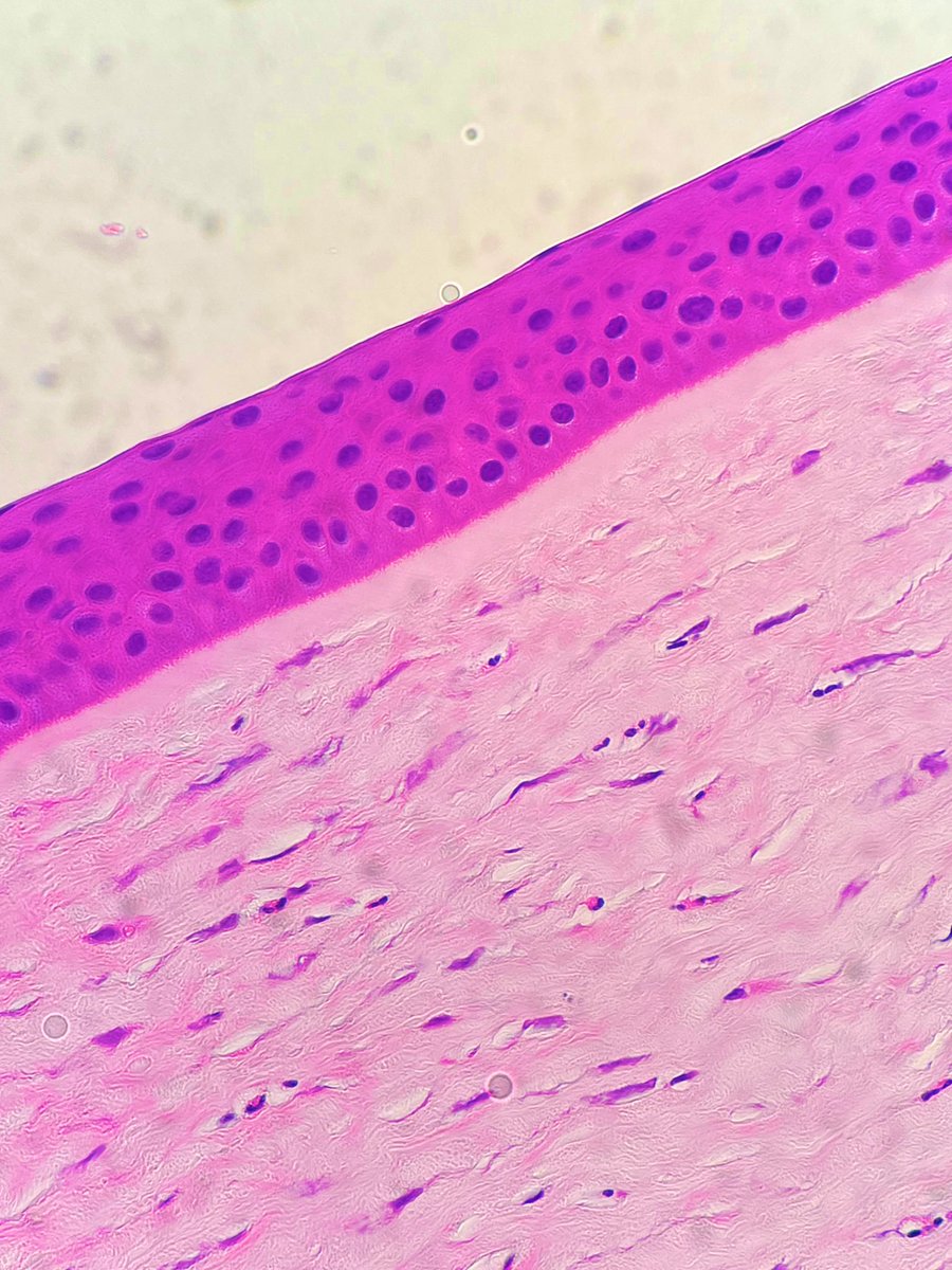 Name the tissue 🔬

Hint: It’s something you don’t see everyday 👀

#pathology #Pathtwitter #pathresidency #microscopic #histology