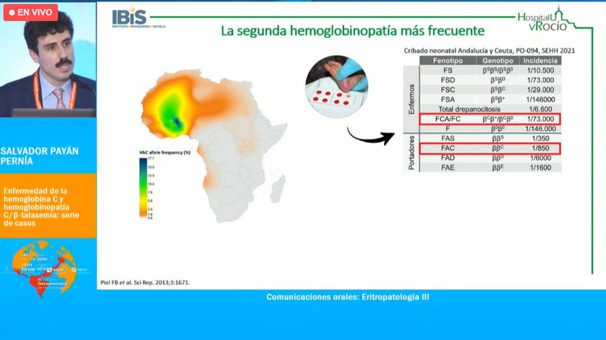 HematoHUVR's tweet image. 📢Comunicaciones orales #Hemato2023 en #gammapatías monoclonales por parte de la Dra. Marta Reinoso y en #Eritropatología por el Dr. @salvadorpayan 👩‍⚕️🩺
Estudio de casos de nuestro centro @HospitalUVRocio @ibis_sevilla 🏥
@sehh_es @SETH__Oficial