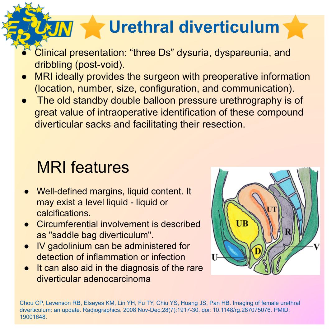 ✅YES, it's a divertivulum. There are many cystic lesions in female pelvis, such as Bartholin gland cyst, Skene and Gartner.
Pre-surgical MRI gives important information. 
It's difficult to show the communication with the urethra, this is why urethrographies are still performed.