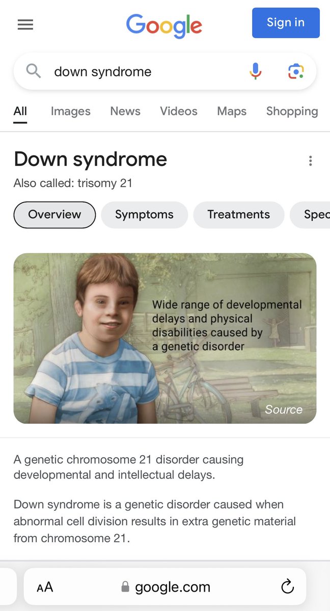 TheResoluteLife's tweet image. A study in CONTRAST…

The first two images are what a @Google search for Down syndrome generates. I challenge you to find another group of humans in @Google search results so inhumanely, callously and erroneously labeled by “medical experts.”

The last image?

The last image is…