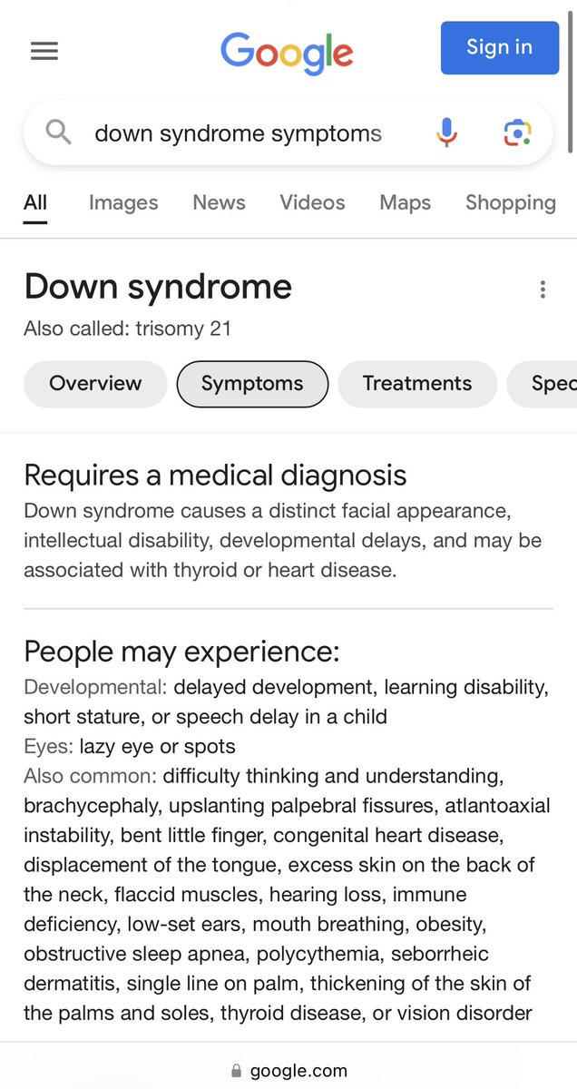 TheResoluteLife's tweet image. A study in CONTRAST…

The first two images are what a @Google search for Down syndrome generates. I challenge you to find another group of humans in @Google search results so inhumanely, callously and erroneously labeled by “medical experts.”

The last image?

The last image is…