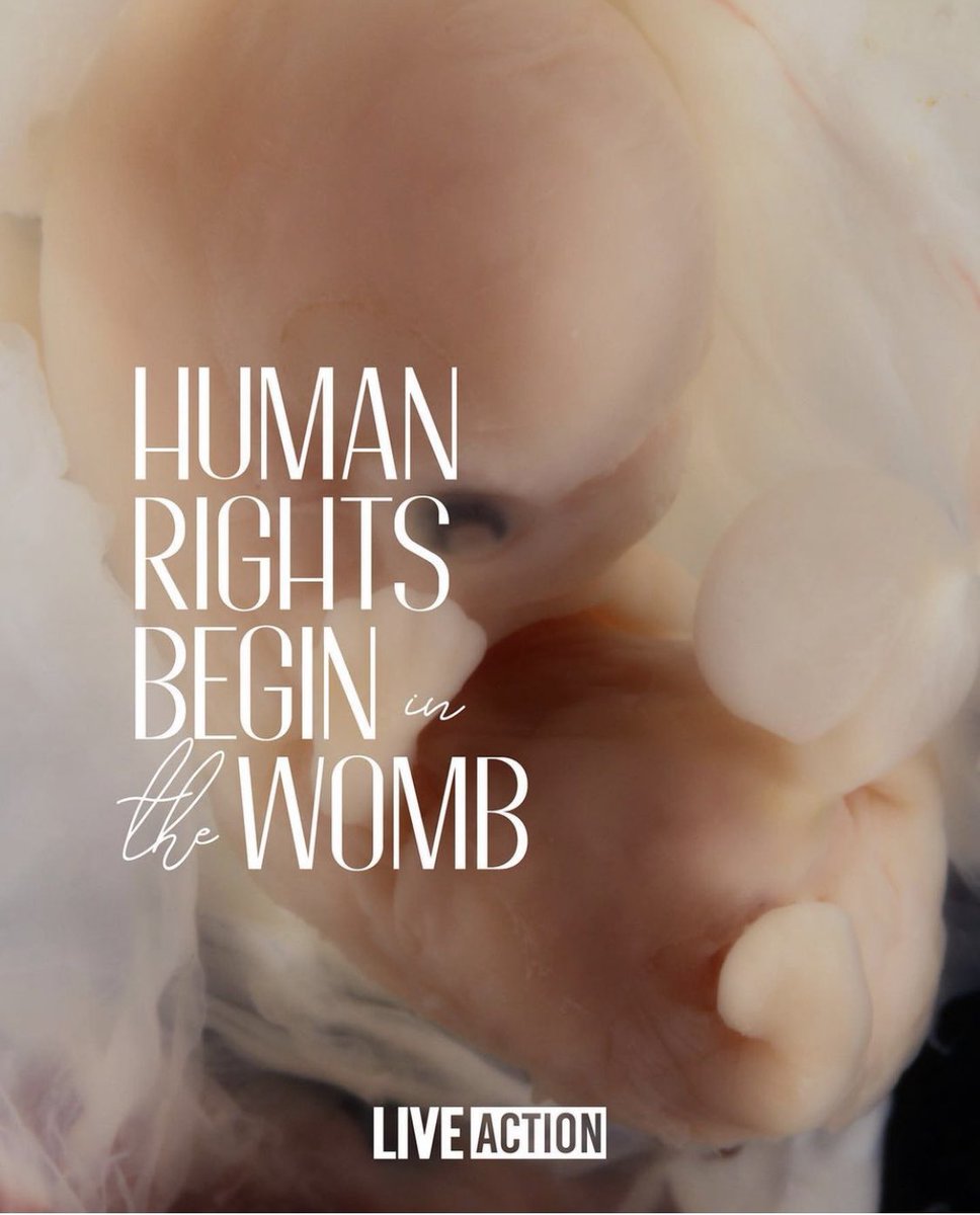 EmilyGrace427's tweet image. Excited to announce that as of today I&apos;m officially a #LiveActionAmbassador ❤️ forever #InItToEndIt