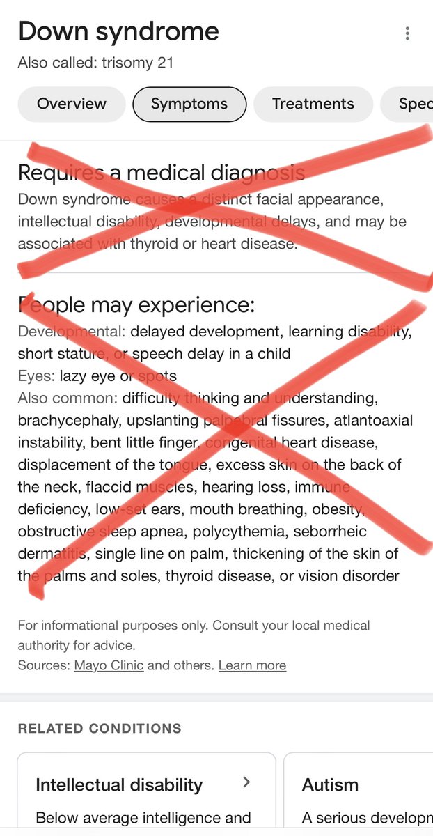 TheResoluteLife's tweet image. Wanna make a DIFFERENCE?

RT this and help us smash the FALSE narratives around Down syndrome!

Relentless.
Forward.
Advocacy.

#SmashingTheNarrative
#TeamIronWill
#DownSyndromeAwareness