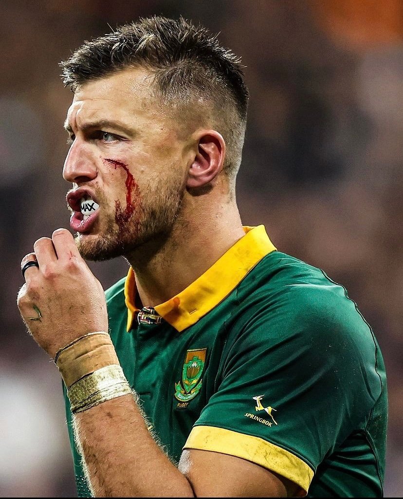 SipheleleQalaba's tweet photo. Scars are temporary, history is forever #Springboks #RWCFinal https://t.co/1fdw7X7pmE