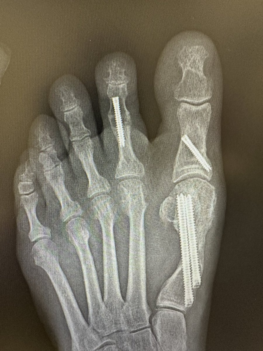 Christopher Miller, MD, MHS, FAAOS tweet media