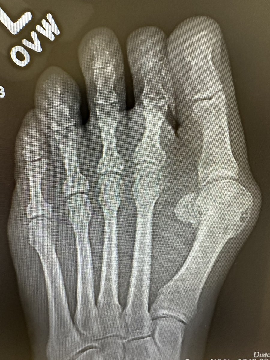 Christopher Miller, MD, MHS, FAAOS tweet media