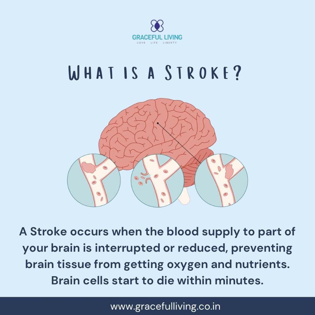 Let's unite for our golden generation 👴👵 this World Stroke Day, spreading love and awareness for a healthier tomorrow!🧠⚕️

#gracefullivingindia #WorldStrokeDay #stroke #brainstroke #healthiswealth #strokeawareness #strokeeducation