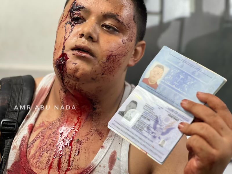 🇺🇸🇮🇱 Israel is TARGETING American citizens trapped in Gaza.