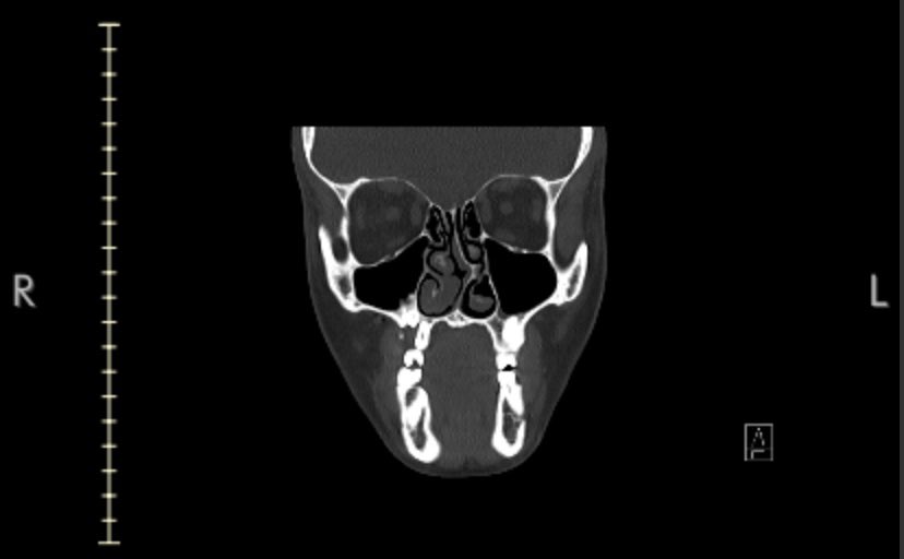 punchSkunk's tweet image. hey y’all sorry for the absence but i was hat3cr!med about two weeks ago. my ptsd has worsened and i need surgery to repair my internal septum so that i can breathe. because of this i’m looking to take coms, ychs, and get rid of some adopts. more info in the following thread 🧵