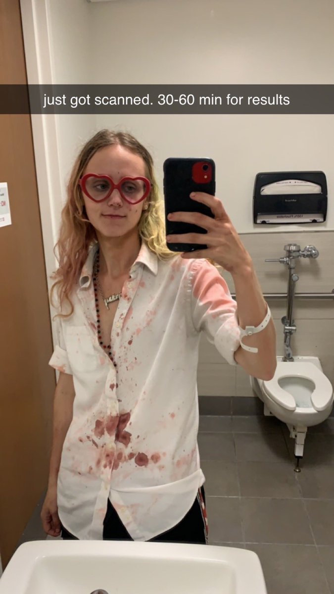 punchSkunk's tweet image. hey y’all sorry for the absence but i was hat3cr!med about two weeks ago. my ptsd has worsened and i need surgery to repair my internal septum so that i can breathe. because of this i’m looking to take coms, ychs, and get rid of some adopts. more info in the following thread 🧵