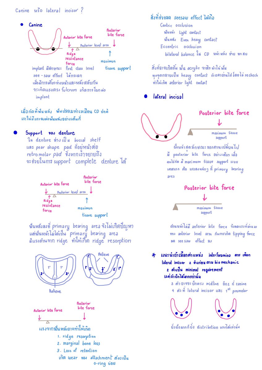 fonkansiri's tweet photo. สำหรับหมอฟันที่รับราชการ หรือที่สนใจ กรมการแพทย์มี DMS E-learning online เรื่องที่เน้นตามโครงการ คือรากฟันเทียมรองรับฟันเทียมทั้งปาก ตามชุดสิทธิประโยชน์ เราจดเลคเชอร์มาให้เพื่อ ใช้อ่านทำความเข้าใจเกี่ยวกับ implant retained denture ประกอบการเรียน  หรือทบทวนค่า โพสนี้เป็น fundamental น้�� #ADResiDent4