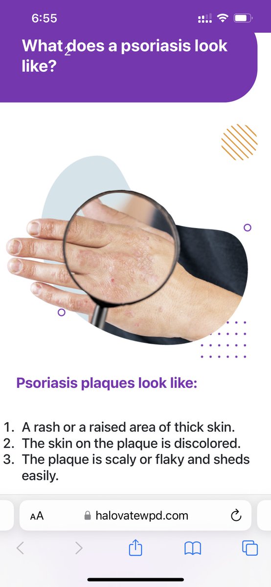 Today’s world psoriasis day that day I pray god who is suffering psoriasis disease he living well life or continue taken treatment as per dr advised because psoriasis dd prolonge time living of the body so only maintaining.
#worldpsoriasisday #dermatology 
#psoriasis #drvinaykr