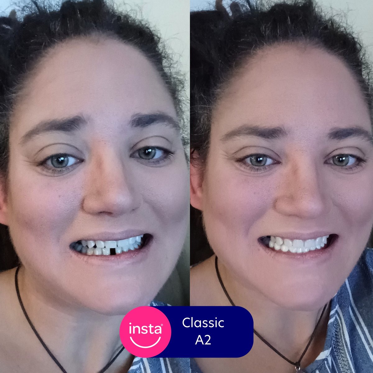instasmile's tweet image. Take a look at Alisha's stunning new smile! Her teeth look absolutely amazing, all thanks to her new instasmile clip-on veneers. 😍 This smile makeover has truly transformed her look and boosted her confidence!

#instasmile #smilemakeover #cliponveneers #newsmile #missingteeth