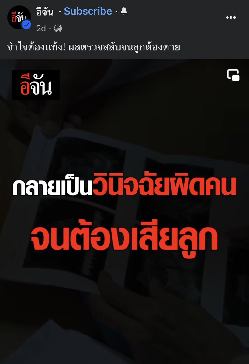 sorkorlao's tweet photo. แกรรรร เรื่องนี้ แย่มาก แย่มากๆๆๆๆๆ #รพชุ่ยสลับผลเลือด 

TW : เป็นเรื่องราวสะเทือนใจเกี่ยวกับการแท้งลูก

ขอบคุณที่อีจันได้เผยแพร่ เรื่องนี้ออกมา 

- มีผู้หญิงคนนึง ไปตรวจสุขภาพฝากครรภ์ กับ รพ แห่งนึง

- พอผลออก ���ยาบาลบอกว่า คุณแม่มีความเสี่ยงสูงมาก ที่ลูกจะเป็น
ดาวน์ซินโดรม จะต้องตรวจเพิ่มเติม 

- คุณแม่ไม่อยากตรวจด้วยการเจาะน้ำคร่ำ เลยยอมเสียเงินไปตรวจที่เอกชน โดยการตรวจ NIPT ซึ่งผลการตรวจจะออกวันที่ 6 ตุลาคม

- วันที่ 3 ตุลาคม แม่ไปหาหมอที่ รพ หมอบอกว่าจะต้องเจาะน้ำคร่ำตรวจวันนี้เลย เพราะคุณแม่มีความเสี่ยงสูง คุณแม่บอกว่า รอผลตรวจ NIPT อยู่ จะออกวันที่ 6 หมอบอกว่า ถ้าไม่เจาะวันนี้ ก็จะไม่เจาะให้แล้ว ก็ตั้งครรภ์ต่อไป 

- สุดท้ายด้วยความห่วงลูก คุณแม่ยอมตรวจแบบเจาะน้ำคร่ำ 

- พอเจาะน้ำคร่ำเสร็จ คุณแม่มีอาการปวดท้องและมีเลือดไหล จึงไปถามพยาบาล พยาบาลบอกว่าถ้ามีไข้ขึ้นสูงและมีน้ำเดินเยอะก็กลับมา

- คุณแม่กลับบ้าน และไปนอนนิ่งๆ ไม่ขยับตัวตามที่หมอสั่ง แต่ก็ยังคงมีเลือดและน้ำไหลออกมาอยู่ คุณแม่เลยใส่ผ้าอนามัย 

- เช้าวันต่อมา คุณแม่ไม่ปวดท้องแล้ว แต่ยังมีน้ำไหลออกมาอยู่ ก็เลยลุกขึ้นมาเปิดสมุดประวัติคนไข้ดู จึงพบว่า ผลตรวจสุขภาพในสมุดของคุณแม่ เป็นชื่อคนอื่น 

- คุณแม่เลยกลับไปที่ รพ เพื่อถามเจ้าหน้าที่พยาบาลว่า เกิดอะไรขึ้��� ทำไม���ลตรวจสุขภาพจึงเป็นชื่อคนอื่น 

- พยาบาลบอกว่า อ้าว ทำไมผิด วันนั้นไม่ได้ print ประวัติใหม่ ซึ่งคุณแม่ก็ไม่เข้าใจว่า คำว่า ไม่ได้ print ประวัติใหม่หมายถึงอะไร 

- พยาบาลจึง print ประวัติใหม่ แล้วเอาประวัติใส่เข้าไปในสมุดประวัติของคุณแม่ แล้วบอกคุณแม่ว่า กลับบ้านได้ 

มีต่อ