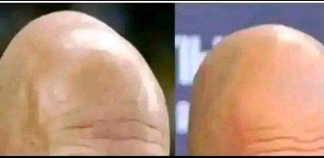 #MUNMCI  man u need to reset this shape