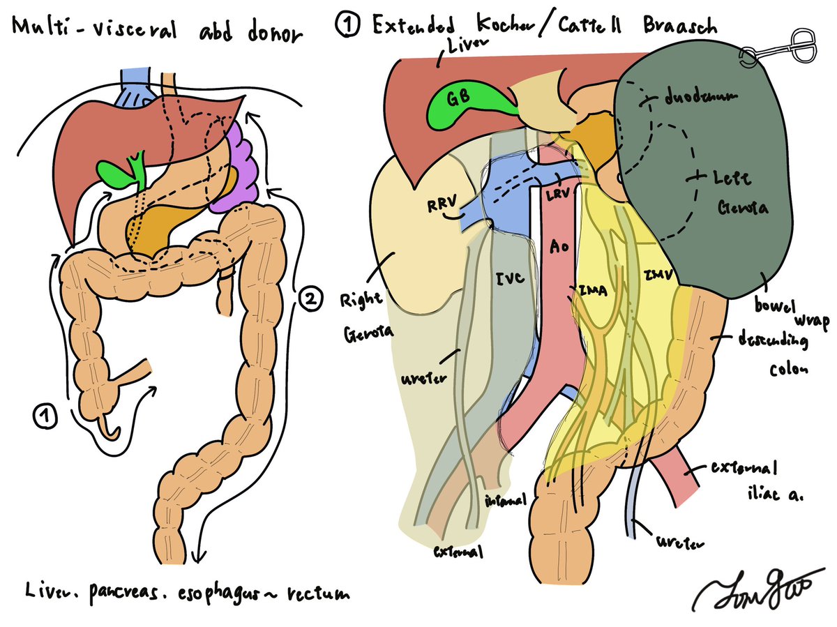 Toru Goto, MD tweet media