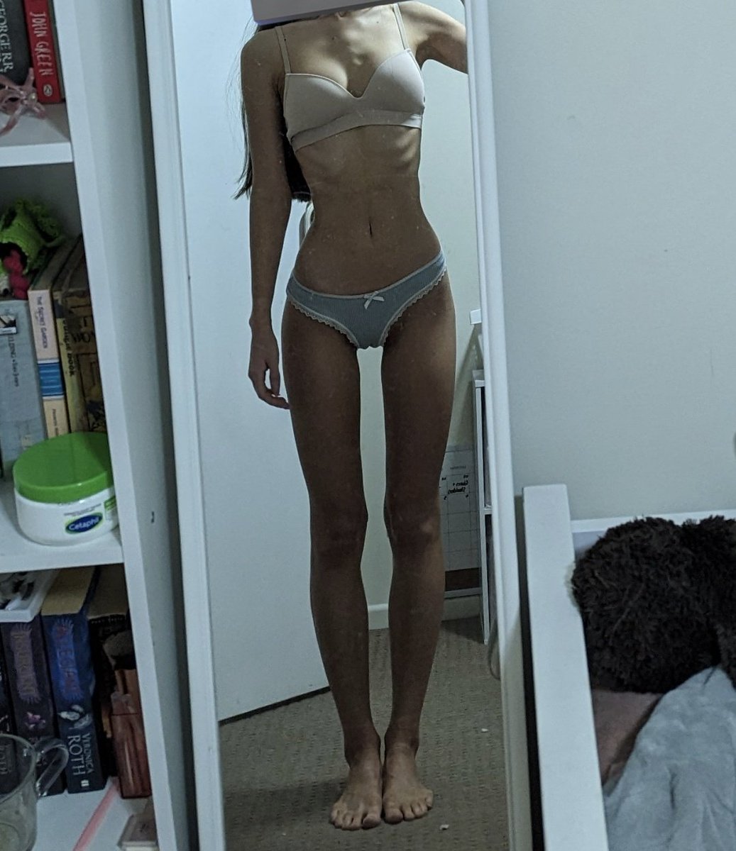 rencors's tweet image. Tw bodycheck

yall... exactly one year difference between these two photos  

Oct 29 2022 vs Oct 29 2023