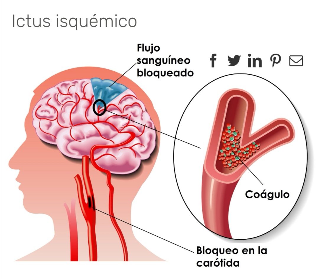 Txema Almela tweet media
