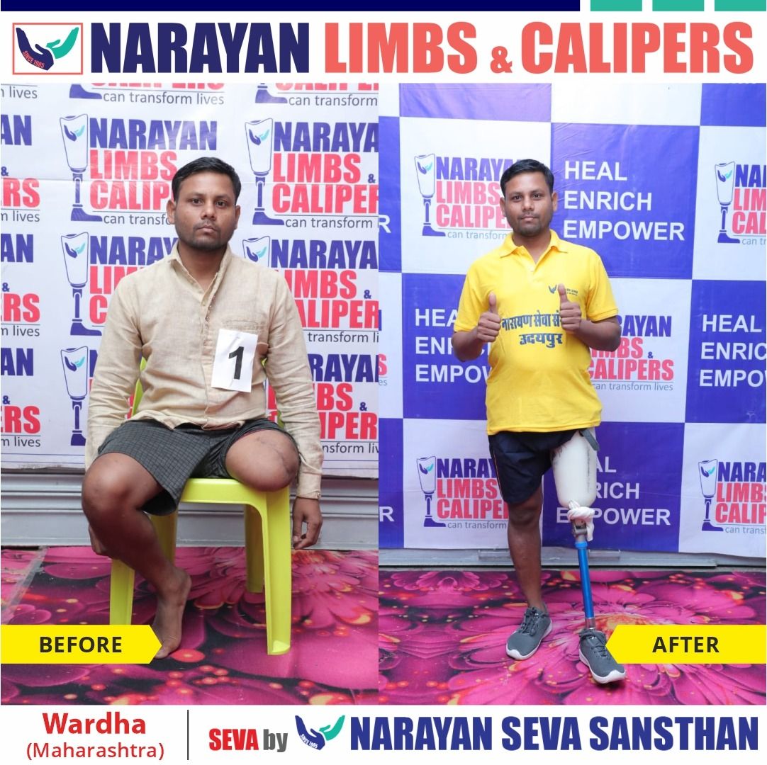 narayanseva_'s tweet photo. आज, नारायण सेवा संस्थान ने वर्धा, महाराष्ट्र में नारायण लिम्ब एंड कैलिपर फिटमेंट कैंप का आयोजन किया, जिसमें निःशुल्क कृत्रिम अंग के साथ अन्य सहायक उपकरणों प्रदान किए गए। लाभान्वित हुए सभी दिव्यांगजनों के चेहरे पर खुशी की लहर देखने को मिली।
#wardha #India #narayanlimb #freeartificiallimb #artificiallimbcamp #freetreatment #camp #ngo #differentlyabled #maharashtra