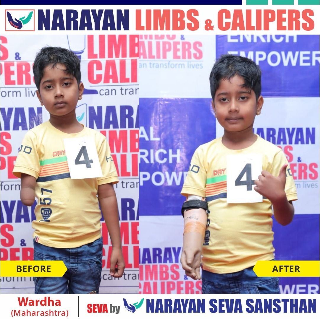 narayanseva_'s tweet photo. आज, नारायण सेवा संस्थान ने वर्धा, महाराष्ट्र में नारायण लिम्ब एंड कैलिपर फिटमेंट कैंप का आयोजन किया, जिसमें निःशुल्क कृत्रिम अंग के साथ अन्य सहायक उपकरणों प्रदान किए गए। लाभान्वित हुए सभी दिव्यांगजनों के चेहरे पर खुशी की लहर देखने को मिली।
#wardha #India #narayanlimb #freeartificiallimb #artificiallimbcamp #freetreatment #camp #ngo #differentlyabled #maharashtra