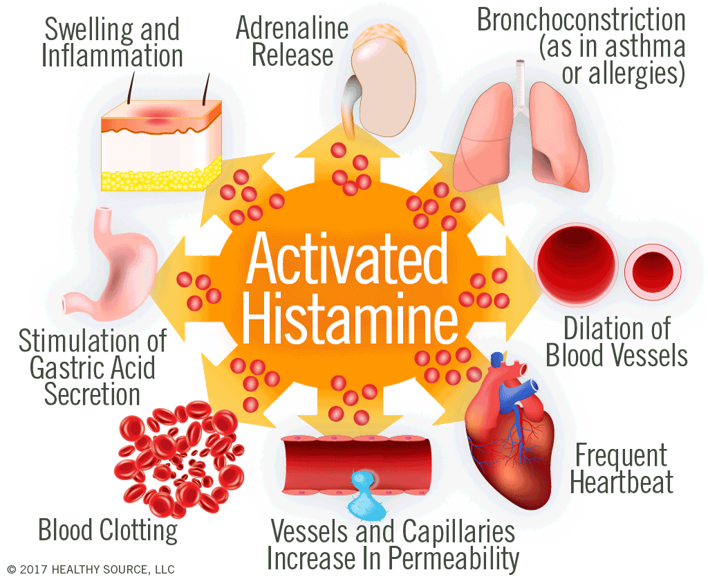 teachingrounds's tweet photo. For #LongCOVID autonomic sx, try hydration (with electrolytes), compression stockings, &amp; antihistamines a la MCAS treatment (fexofenadine, famotidine, montelukast).
Pro-Tip: Orthostatic tachycardia is more common than orthostatic hypotension.
#TeachingRounds, #FOAMed, #IDMedEd https://t.co/Zdc0ieHPph