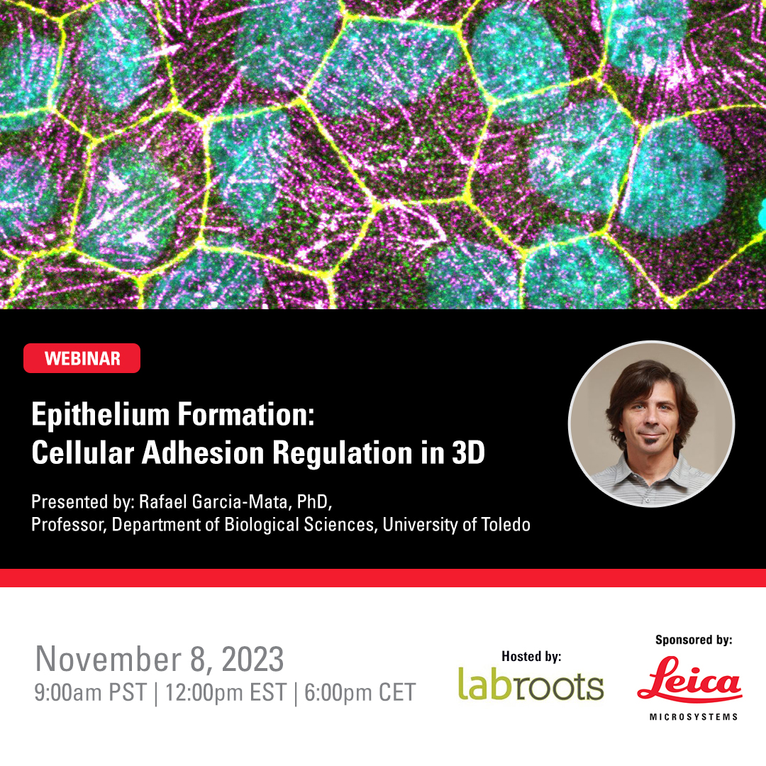 🚀Join @RhoPower Rafael Garcia-Mata, PhD as he discusses techniques to study epithelial cell architecture in 2D & 3D. 🚀Learn how #molecular mechanisms regulate the formation of adherens junction and tight junctions in #epithelial cells. 👉fcld.ly/e20thyk #STELLARIS