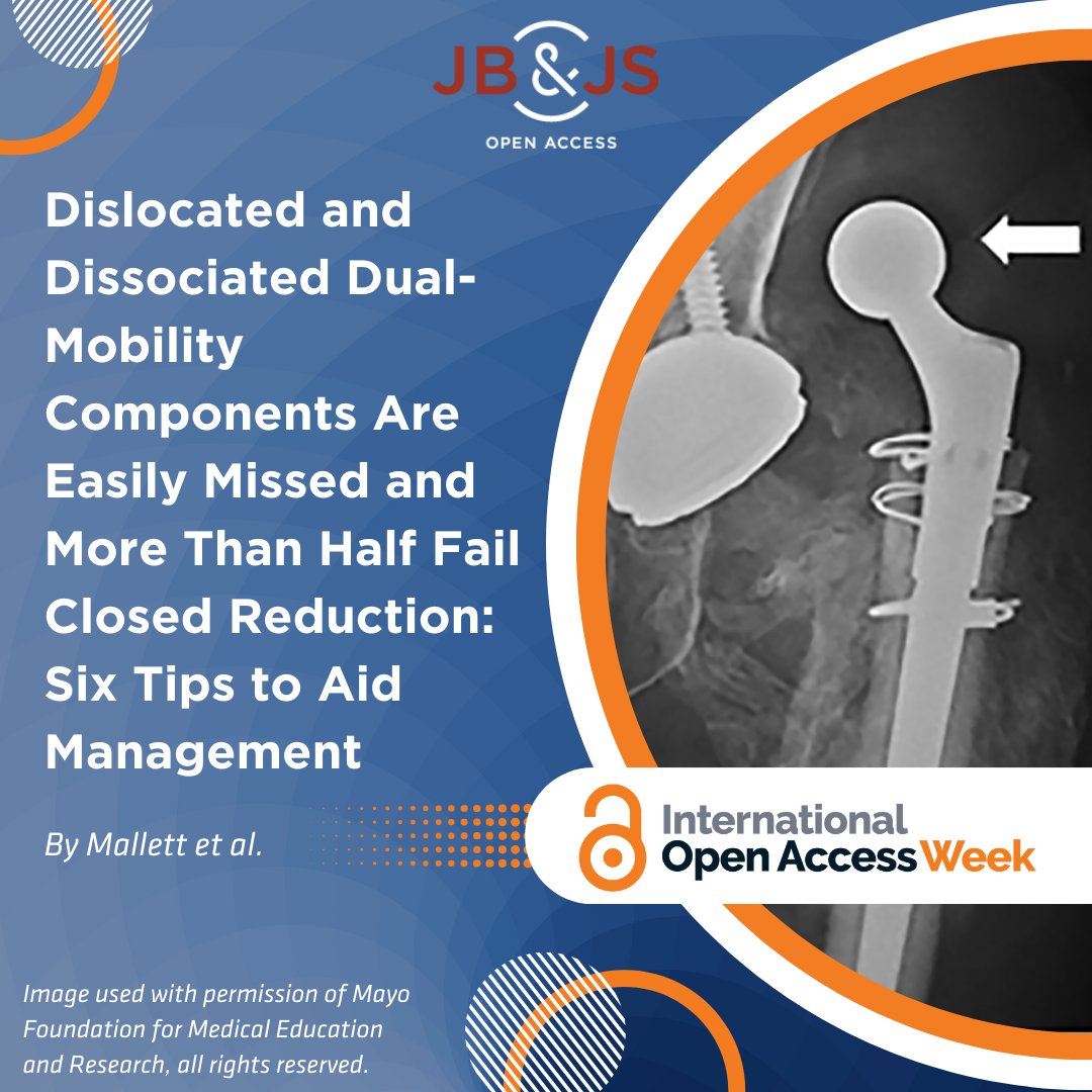 We hope you’ve enjoyed celebrating #OAweek with JBJS! As the week comes to a close, explore this year's most popular articles in JBJS OA.

“Dislocated and Dissociated Dual-Mobility Components Are Easily Missed and More Than Half Fail Closed Reduction':

tinyurl.com/3p7phcc8